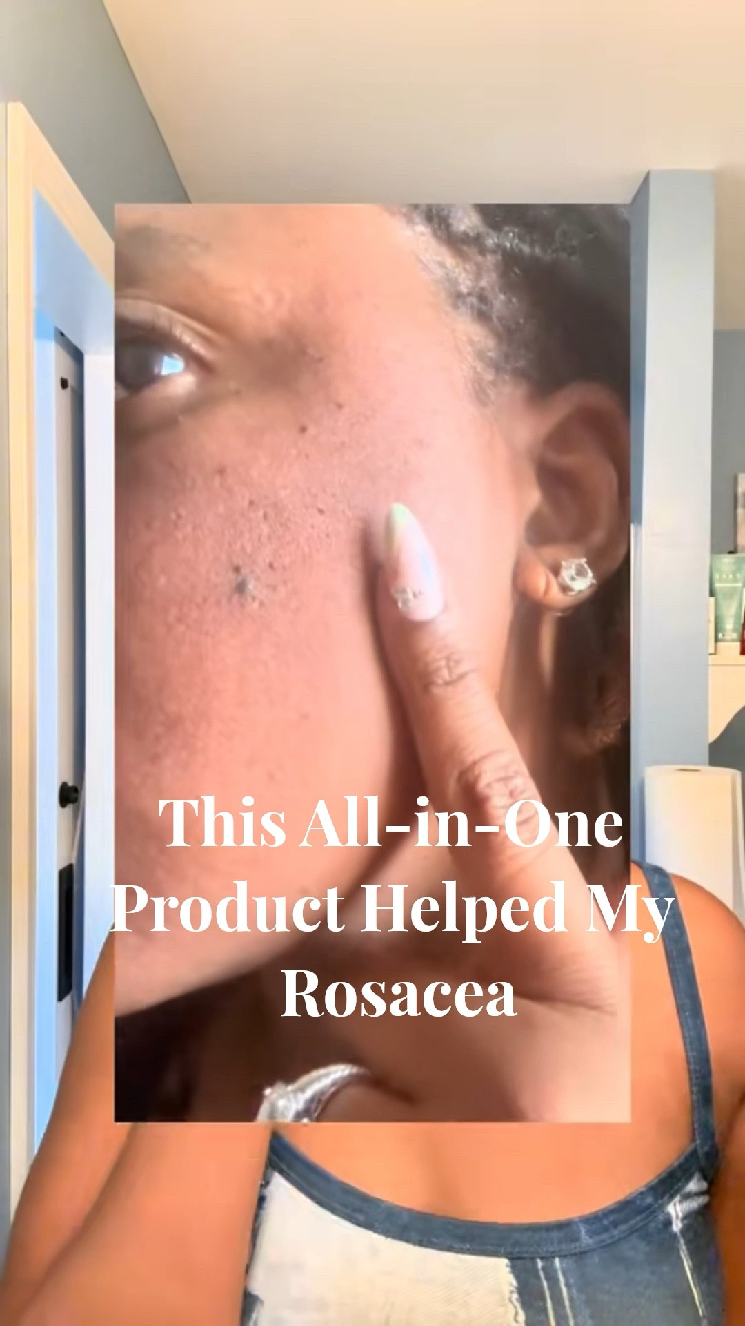 U Beauty Resurfacing Compound: My Rosacea Game-Changer! ✨🌹
Struggling with rosacea redness and uneven texture? I was too—until I discovered U Beauty Resurfacing Compound. This multitasker serum (with stabilized Vitamin C, retinol ester, and multi-hydroxy acids) has visibly calmed my flare-ups, brightened my skin, and smoothed irritation without any harshness.[ubeauty +1]
Living with chronic illness means gentle skincare is essential, and this holy-grail formula replaced multiple steps in my routine while reducing redness around my cheeks and nose. My skin feels renewed, glowy, and more even-toned after consistent use—proof that luxury doesn’t have to mean irritation![dermstore +1]
🛍️ SHOP IT:
Click the link in my bio or follow GlamorousMoni on the LTK App to try it! @ubeauty 
#UBauty #ResurfacingCompound #RosaceaSkincare #SensitiveSkinRoutine @Sephora 

#LTKBeauty #LTKselfcare #LTKOver40