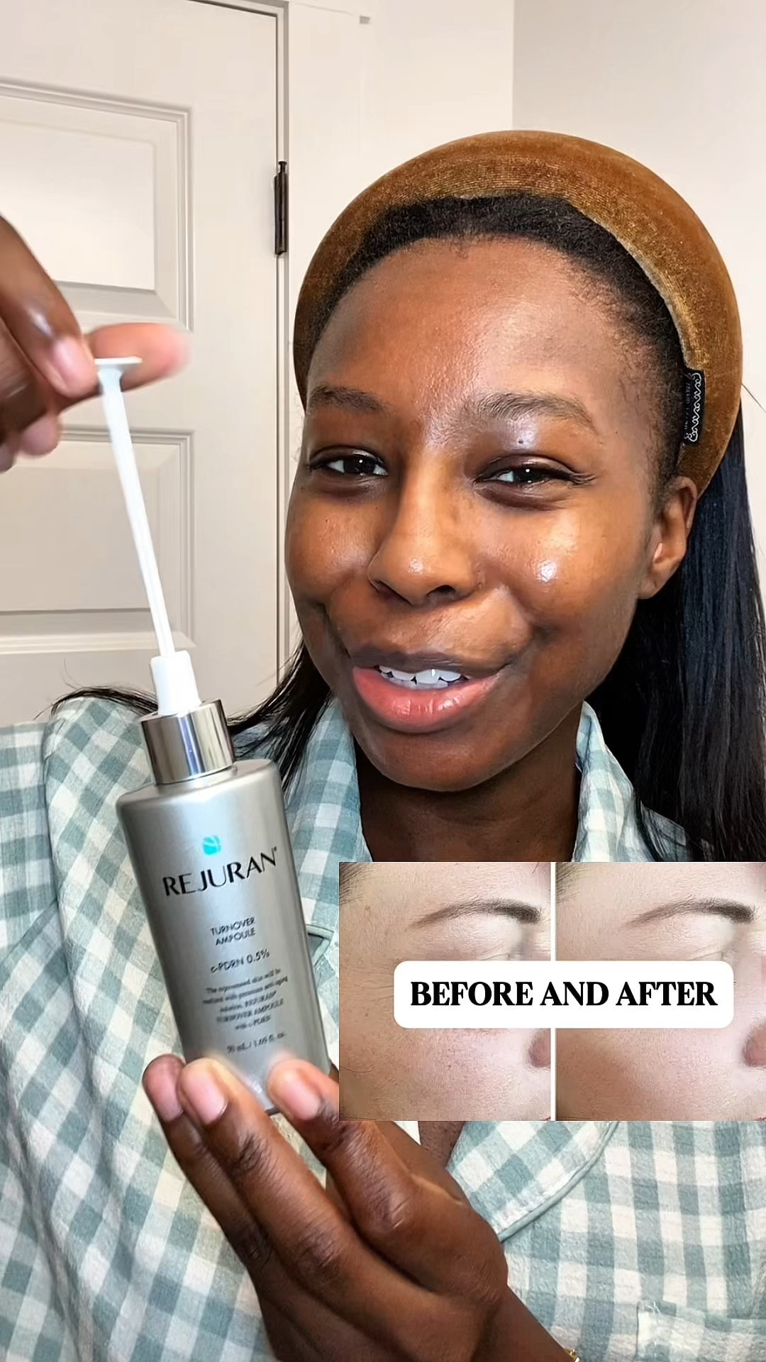 This is not your average serum 👀 REJURAN® Turnover Ampoule with salmon DNA = firmer, glowier, glassier skin. #skintok #rejuranhealer #glassskin #rejuran #TurnoverAmpoule #pdrn #cpdrn #salmondna #pdrnserum

#LTKBeauty #LTKFindsUnder100 #LTKFindsUnder50