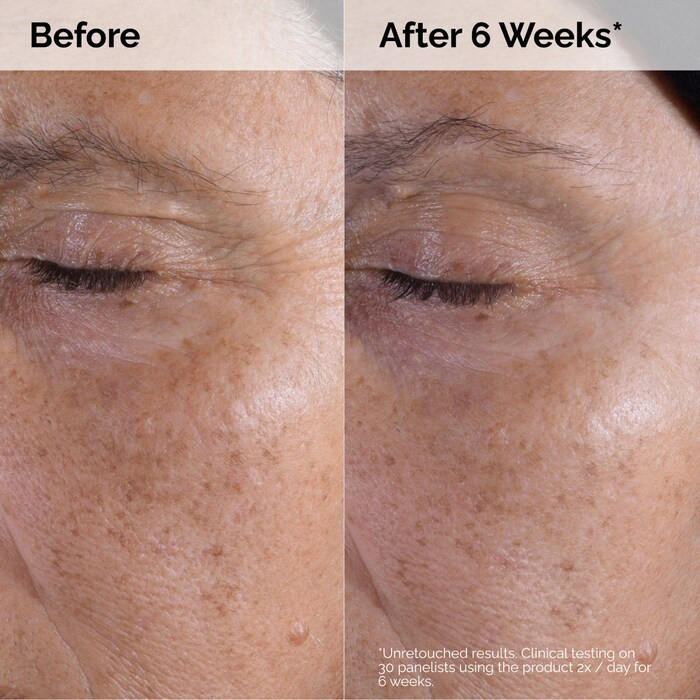 Glycolic Acid 7% Exfoliating Toner | Sephora (US)