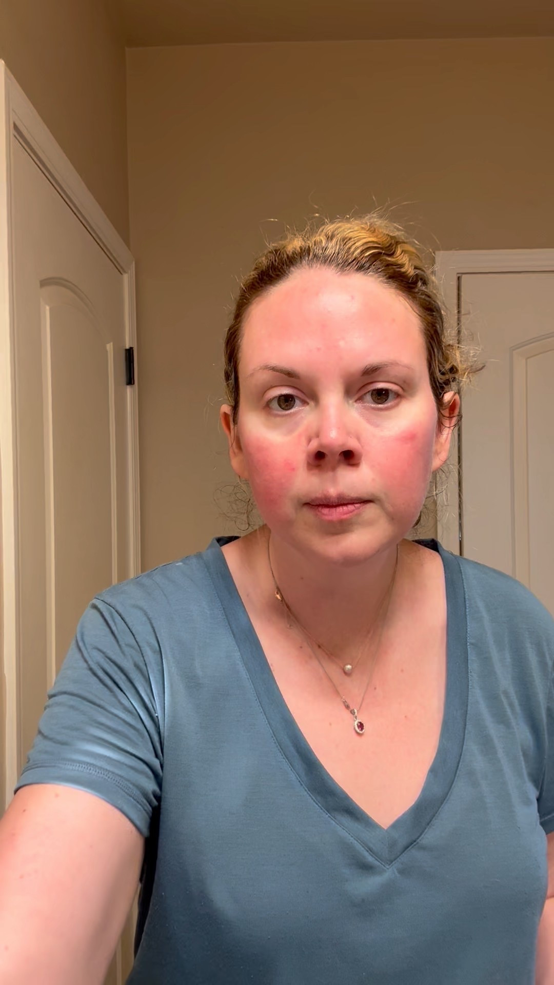 Plenty of outside in the sun time today was a good reminder to break out the vitamin c moisturizer sunscreen to make sure you are protected from the suns harmful rays and early aging  

#LTKFindsUnder100 #LTKBeauty #LTKTravel