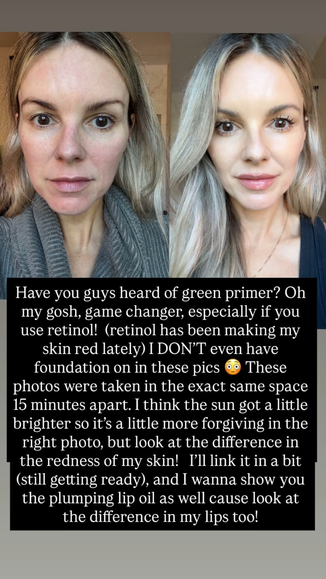 Look at this before and after!

I absolutely love this new Glow Reviver Plumping Lip Oil by e.l.f.! I’m wearing it in shades Dreamsicle, Papayarazzi and Espresso Tonic. It plumps my lips so nicely! The key is overdrawing with a slightly darker lip liner. I’m using this $3 liner by e.l.f. in shade Pink Cinnamon.

I also love this green primer for neutralizing the redness in my skin. It’s been so red lately from using retinol. And then I just put the Halo Glow Skin Tint 50 spf (shade light warm) over it to protect my skin and for a little glow.

@elfcosmetics #ElfPartner #CrueltyFree

#LTKmorningroutine #LTKBeauty #LTKselfcare