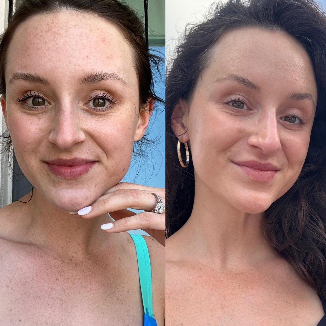 2022 —- 2026 

Linking at the products that WORKED FOR ME 🫶🏻 

Melasma has been my enemy but I have fought it & will continue!

#LTKgrwm #LTKselfcare #LTKBeauty