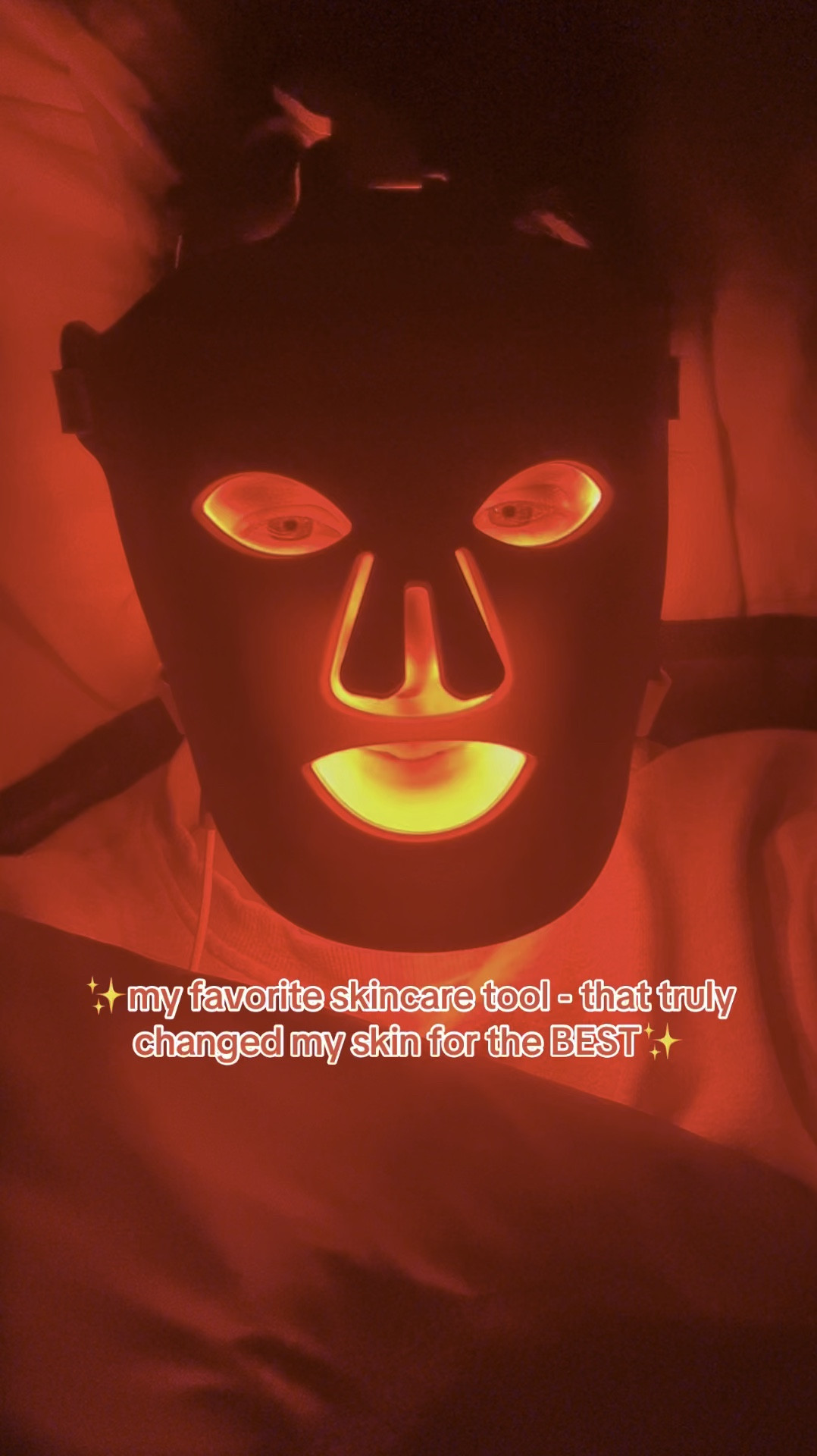 taking my skincare routine to the next level with the higherdose red light face mask! - link in my comments to shop! #higherDOSEpartner

✨ designed to support radiant-looking skin, this red light therapy mask is perfect for a relaxing self-care moment. 

✨ consistency is key! 

#TheBanannieDiaries 
#higherdose #redlighttherapy #skincaretech #selfcareessentials #healthyskin #ltkbeauty

#LTKGiftGuide #LTKWatchNow #LTKBeauty