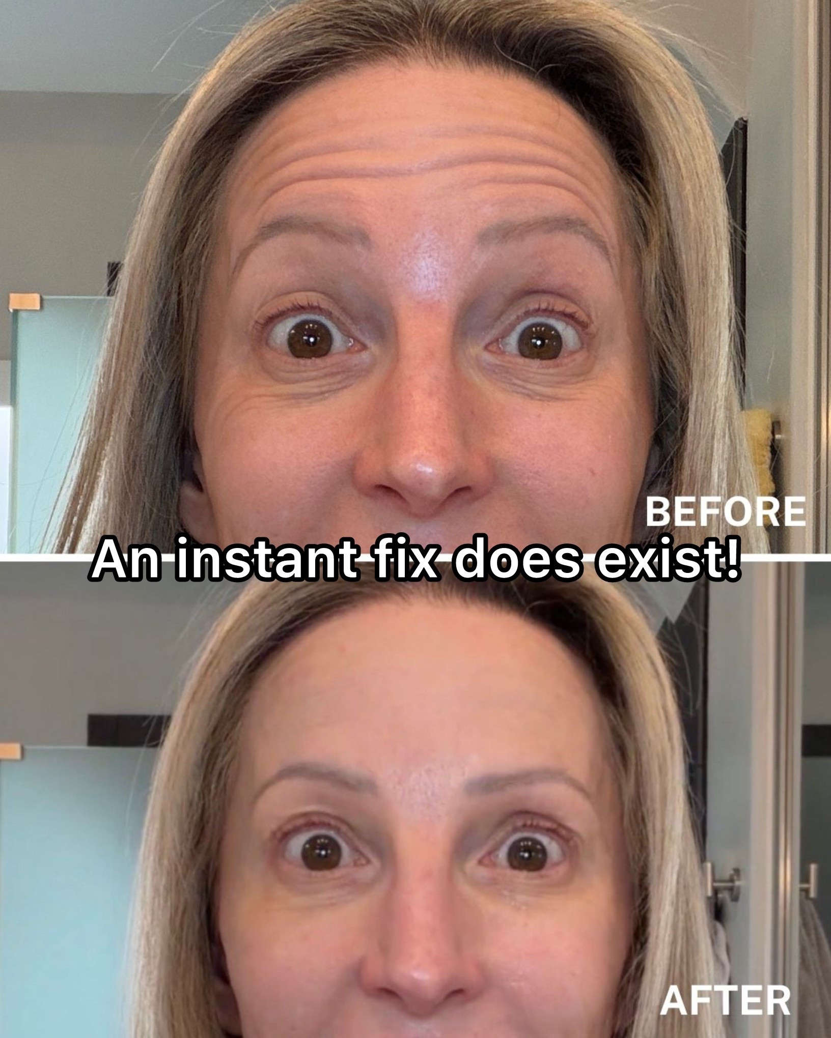 #ad Dr Brandt's Wrinkle Release Serum makes some bold claims. Here's my honest verdict on this Botox in a bottle. PS for the best results use with Dermal Micro Points a couple of times a week in the evening.

I've been testing the Dr Brandt Wrinkle Release Serum and the before and after results speak for themselves: 

Gifted. Use my discount code EVE20 for 20% OFF.

#skincare #antiagingskincare #wrinkleserum #drbrandtskincare

#LTKOver40 #LTKSaleAlert #LTKBeauty