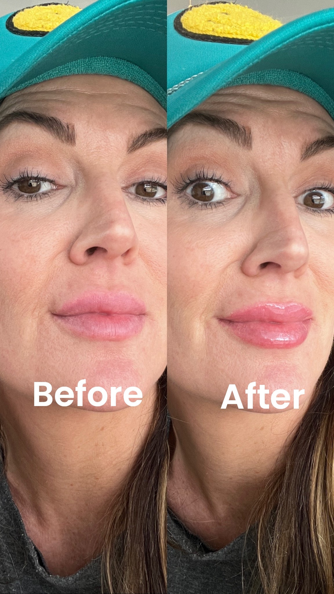 👄 LEGIT, LIP PLUMPING GLOSS! Not for the faint of heart, it burns, a bit 😉 but it works!! I bought the travel size to make sure I liked it first! Lasts around 30 minutes. The clear color brings a nice shade of natural pink to the lips! 

#LTKOver40 #LTKgrwm #LTKBeauty