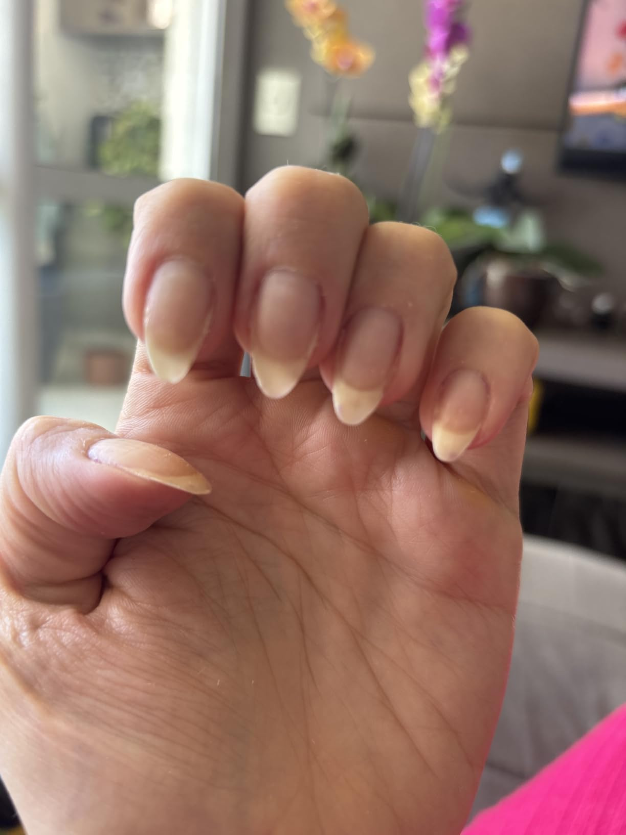 Granado Base SOS 7 Em 1 Pink, 10ml | Amazon (BR)