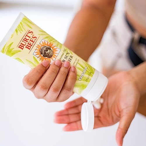 Burt's Bees After Sun Lotion with Hydrating Aloe Vera & Coconut Oil - Summer Essentials, Sunburn ... | Amazon (US)