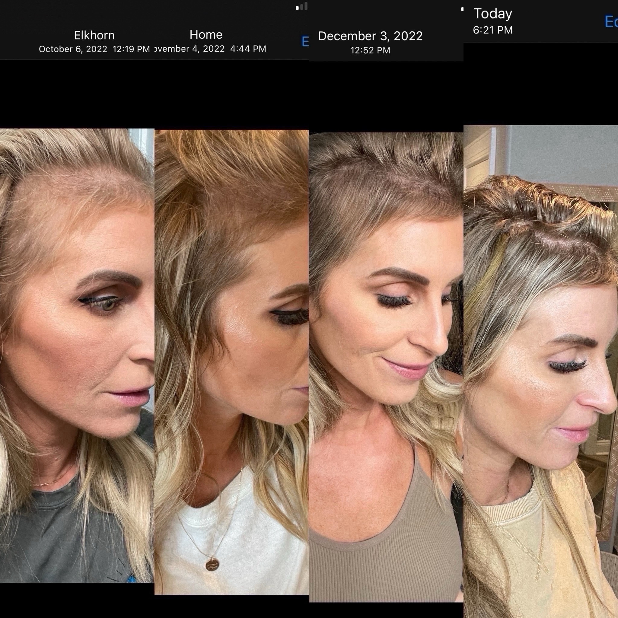 My 3 month progress after using this hair serum. It’s water based so doesn’t leave your hair greasy 

#LTKBeauty #LTKMostLoved #LTKFindsUnder100