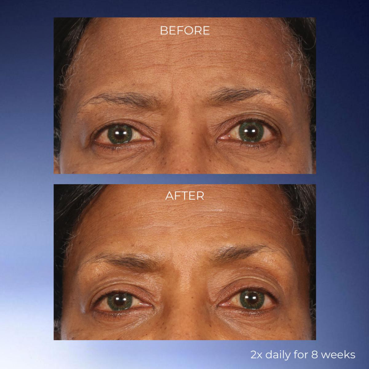 Lancôme Genifique 3.8 oz. Ultimate Serum Jumbo and Travel Set | HSN