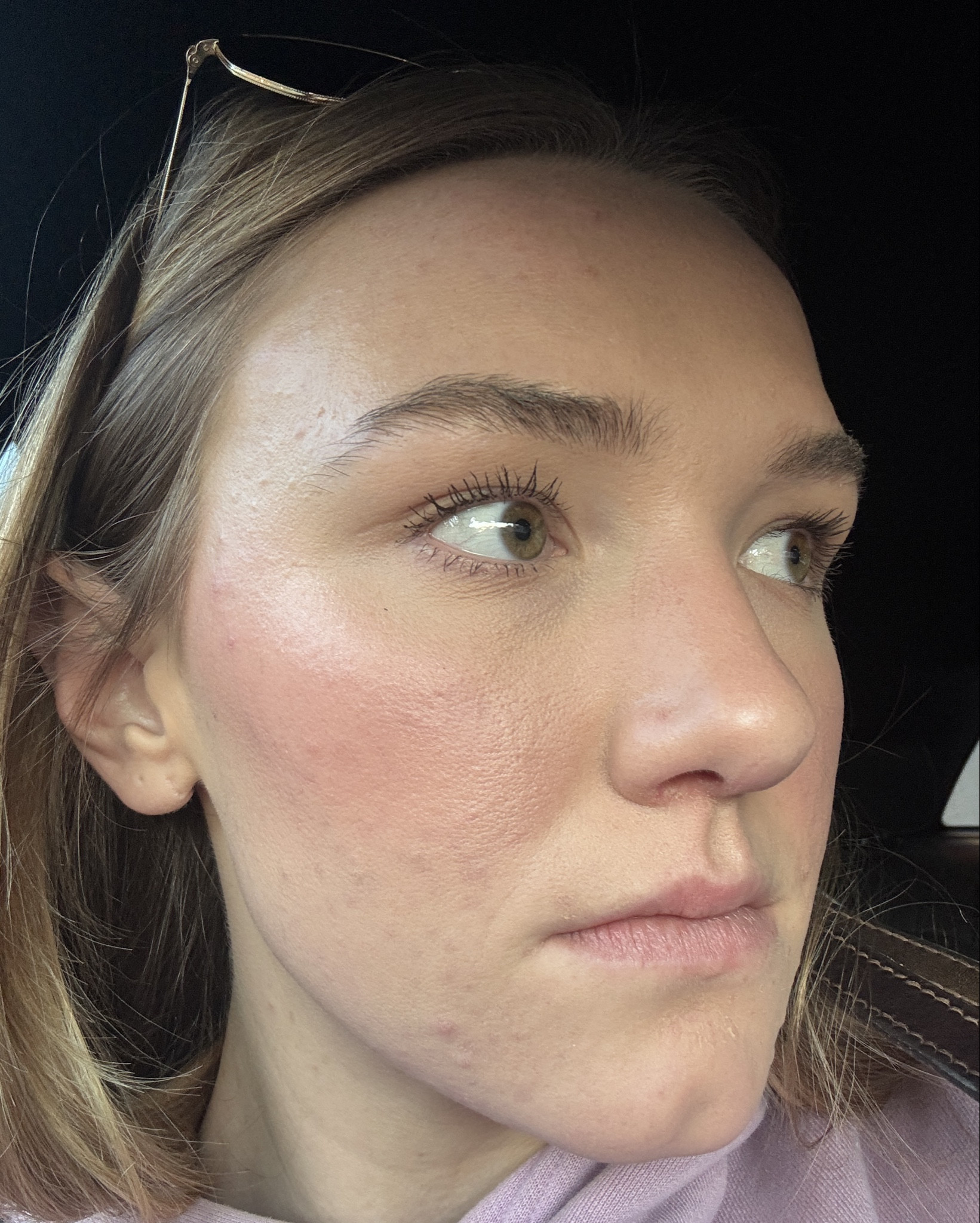 Acne-prone skin natural makeup!!

#LTKBeauty