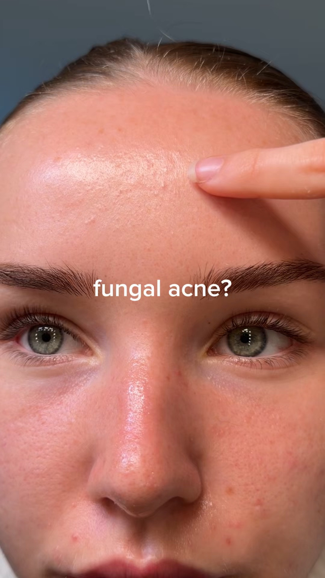 skin concern🤝 these ingredients

Use code LIFEWITHMILS for discount on dr sams (the neutralising gel)⭐️