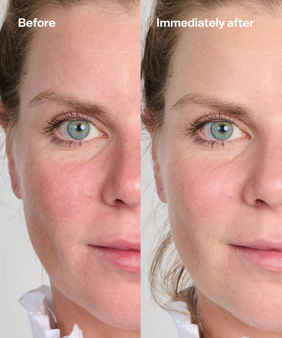 Secret Agent | Bubble Skincare