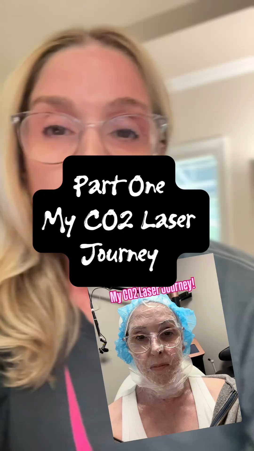 Part One of my CO2 laser journey! have any questions drop them below!

#LTKvlog #LTKOver40 #LTKBeauty
