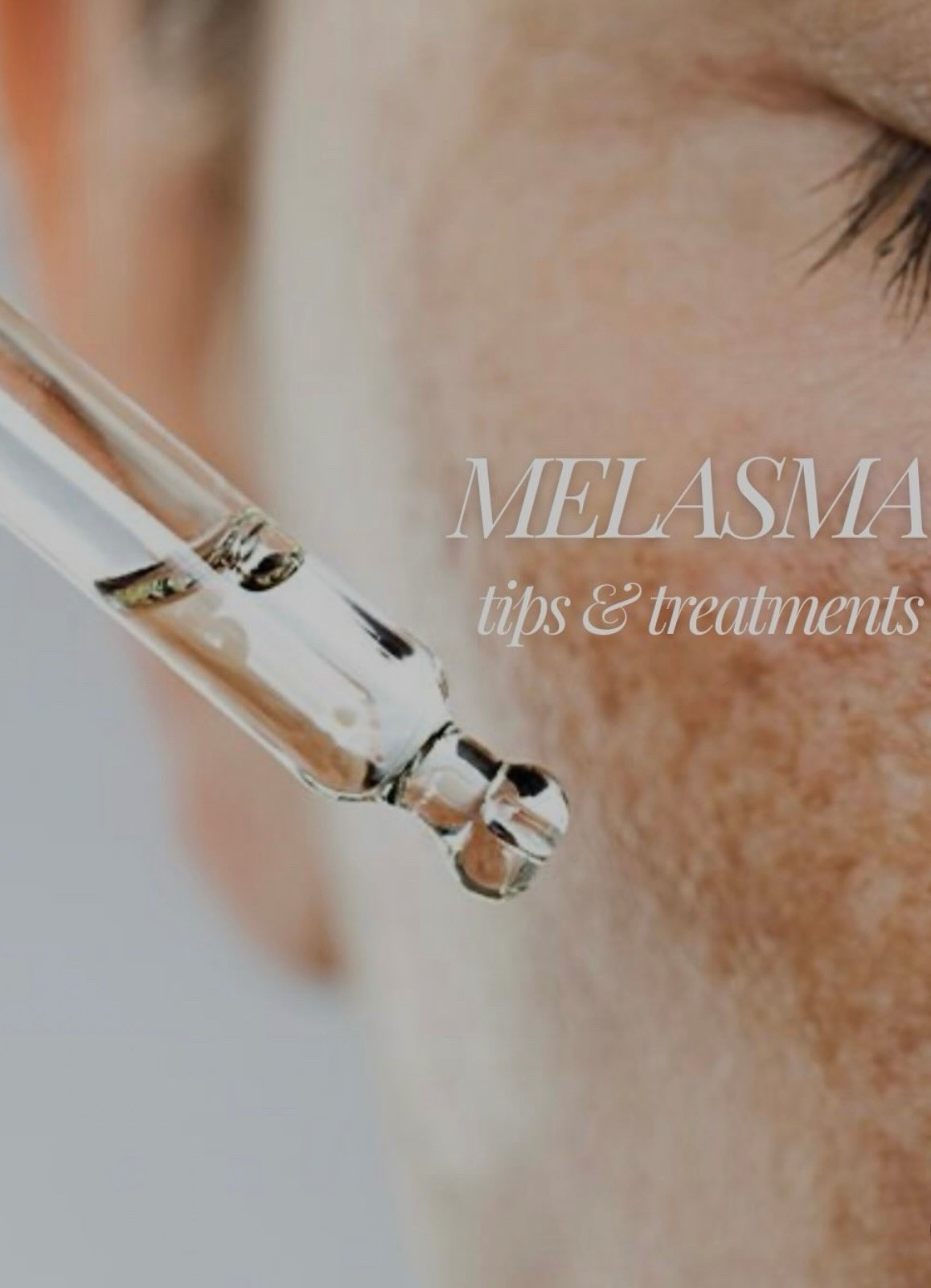 Melasma treatments:
Accurate recommended regimens are crucial to treatment outcomes
Topical agents: Hydroquinone, azelaic, kojic, or tranexamic acid 
Retinoids: to promote skin turnover, start low and increase per tolerated
Vitamin C: inhibits the enzyme (tyrosinase), responsible for melanin production. It acts as an antioxidant, protecting skin from sun-induced inflammation.

#LTKmorningroutine #LTKselfcare #LTKgrwm