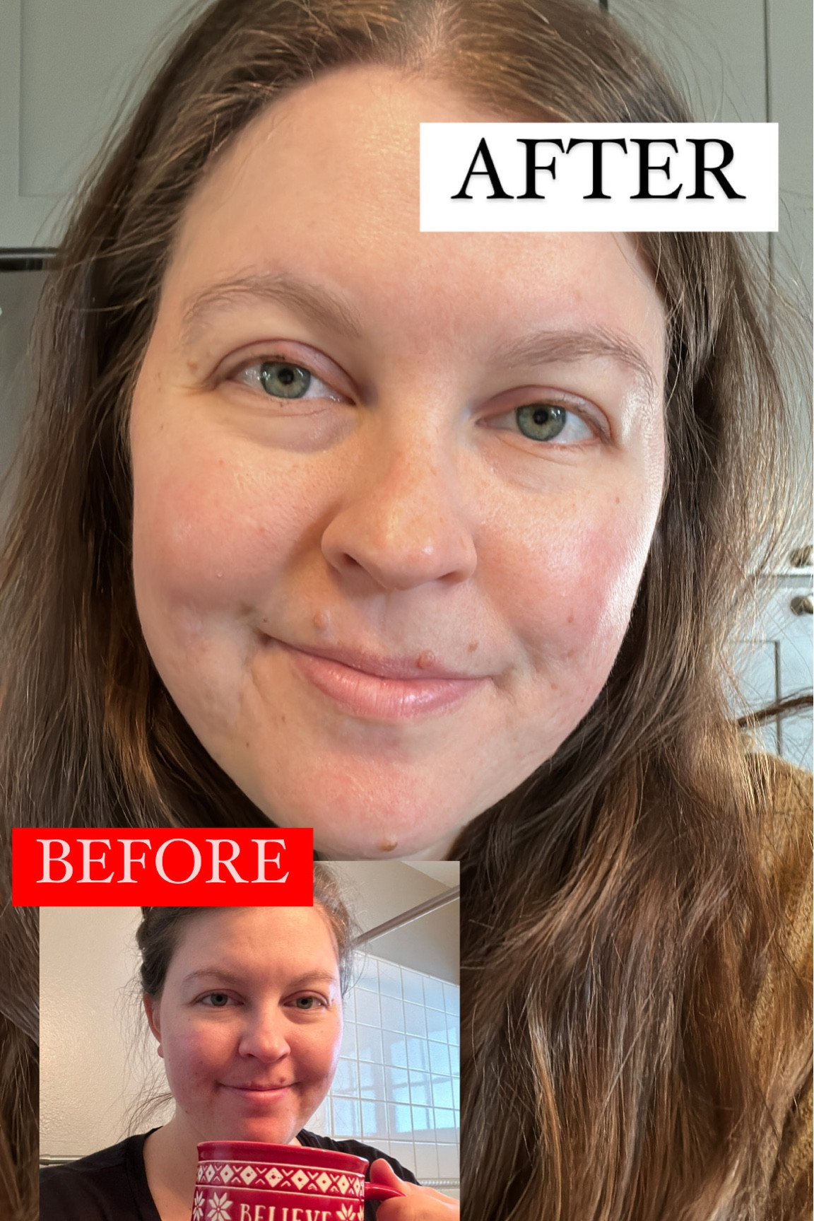 Before & after using Inky List caffeine eye cream ✨ #nofilter #nomakeup 

#LTKunder50 #LTKbeauty #LTKGiftGuide