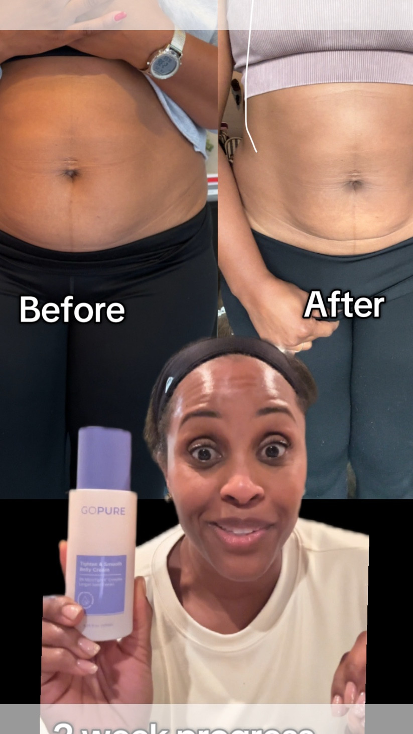 Finally!!! THIS is the belly cream I’ve been looking for!! Clean and safe 🌱

#LTKBeauty #LTKfitnessgoals #LTKmomlife