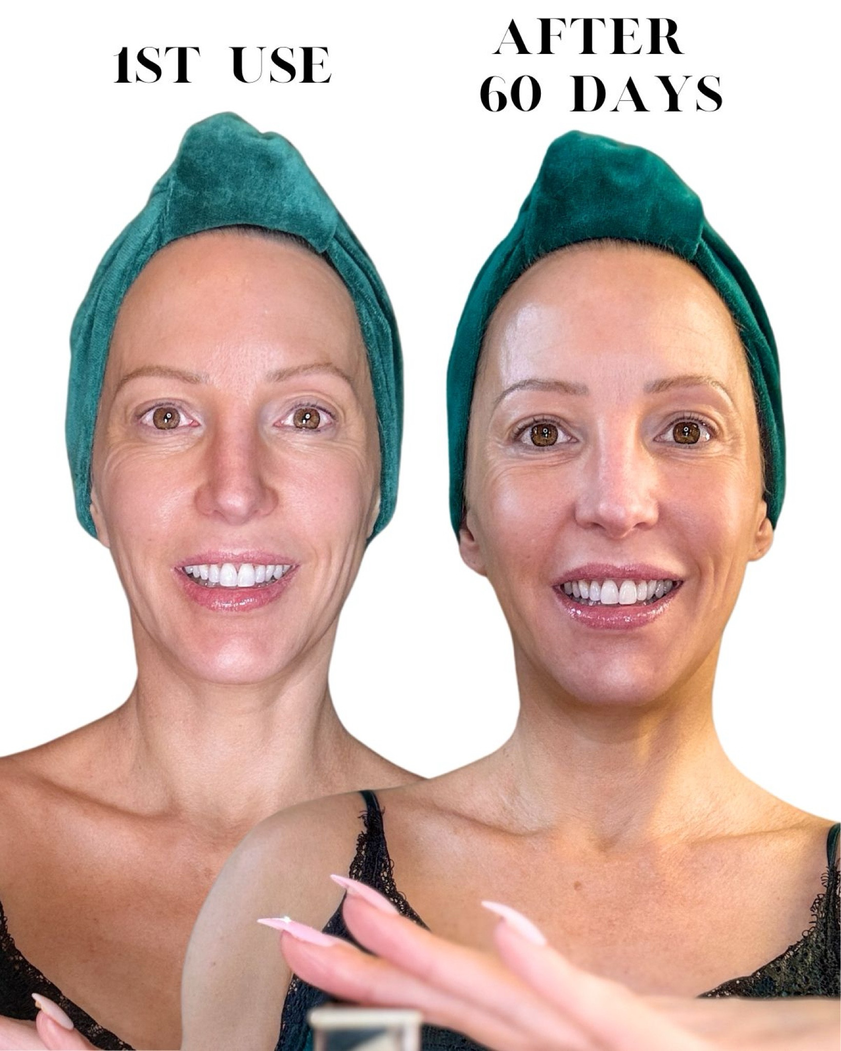 I just posted my Dior Prestige le micro huile de rose Advanced Serum review on YouTube (evedawes) and whether I think this luxury skincare anti aging serum is worth it or not. Complete with my 60 day before and after pic. I definitely feel like it plumped my skin especially under my eyes and made my skin glow. Just know that it’s an expensive habit but at least it’s a good one! Will I repurchase? Watch the video. They also have some lovely Dior beauty gift sets that include this face serum.

#LTKGiftGuide #diorbeauty #diorprestige #diorskincare


#LTKover40 #LTKhome #LTKbeauty