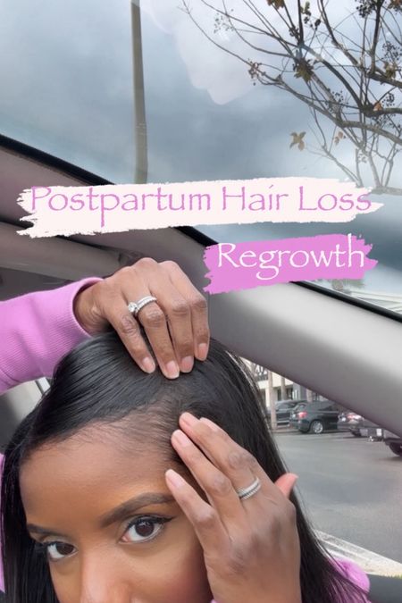 Here’s a list of all the products I use to style my hair. I’ve also included my prenatal and postnatal supplements.

Checkout my instagram hair highlight to see my before and after postpartum hair loss.

Hair loss regrowth postpartum regrowth natural hair 