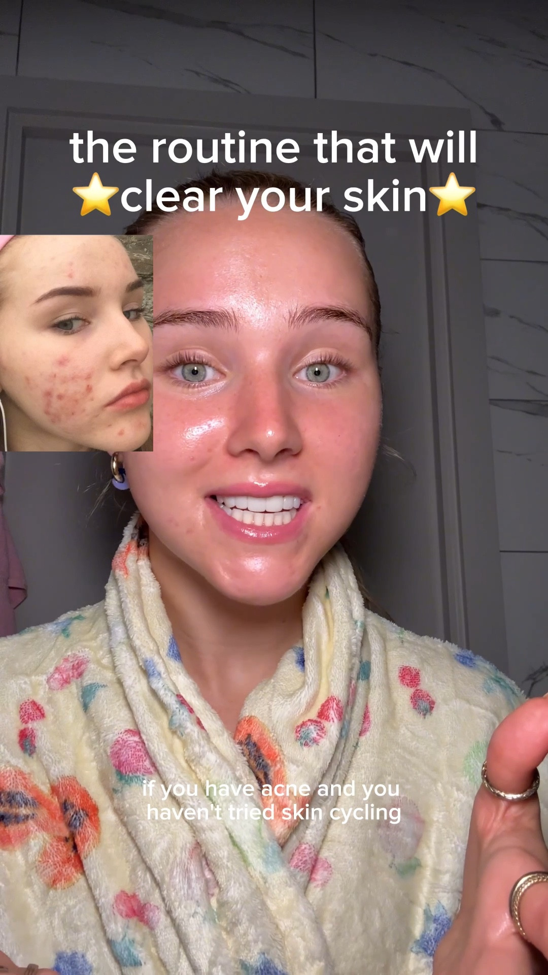 skin cycling day 3⭐️ (the best skincare routine for acne)
code LIFEWITHMILS for discount on everything!