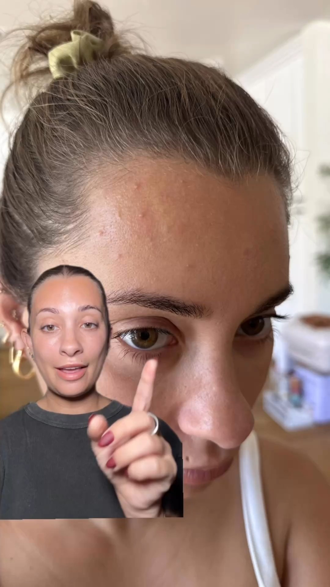 This is how I’ve cleared up my forehead acne in under 1 week! 

#LTKBeauty