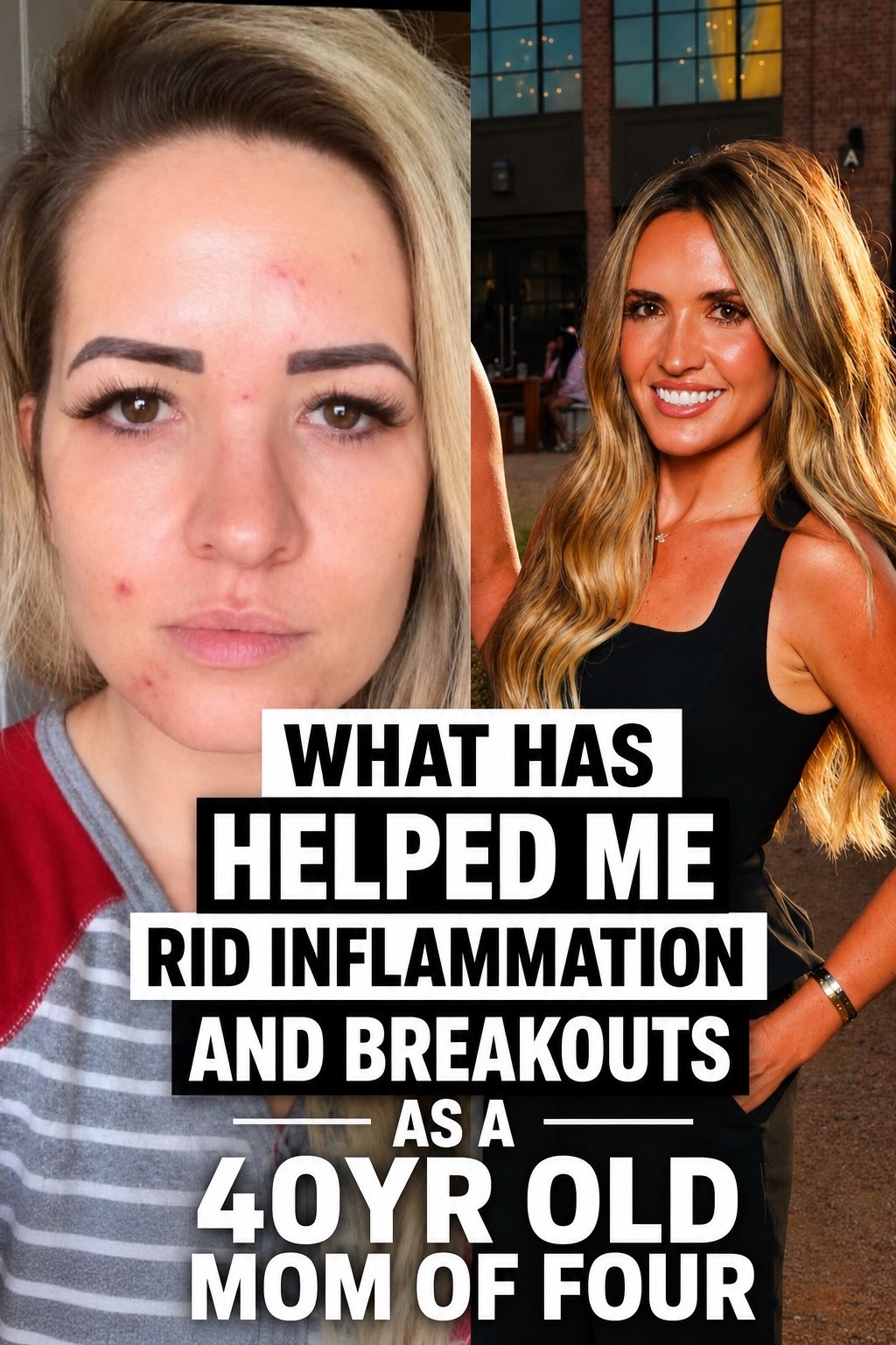 real talk because nobody told me breakouts and inflammation were still a thing at 40.

as a 40 year old mom of 4, my skin has been through a lot and I have tried just about everything under the sun. here are some things that helped me get my skin back to feeling healthy and clean. 🤍 and if you are dealing with this, this is your reminder you are beautiful and you are not alone. 

🔎 adult acne, inflammation, breakouts, skin over 40, skincare over 40, hormonal breakouts, anti aging skincare, clear skin, skincare routine, moms over 40, 40 year old mom, beauty over 40, skincare must haves, how to get clear skin, mature skin, skin tips, beauty favorites

Colorscience spf - shade tan
Ciele powder - shade 2

#LTKmomlife #LTKselfcare #LTKBeauty