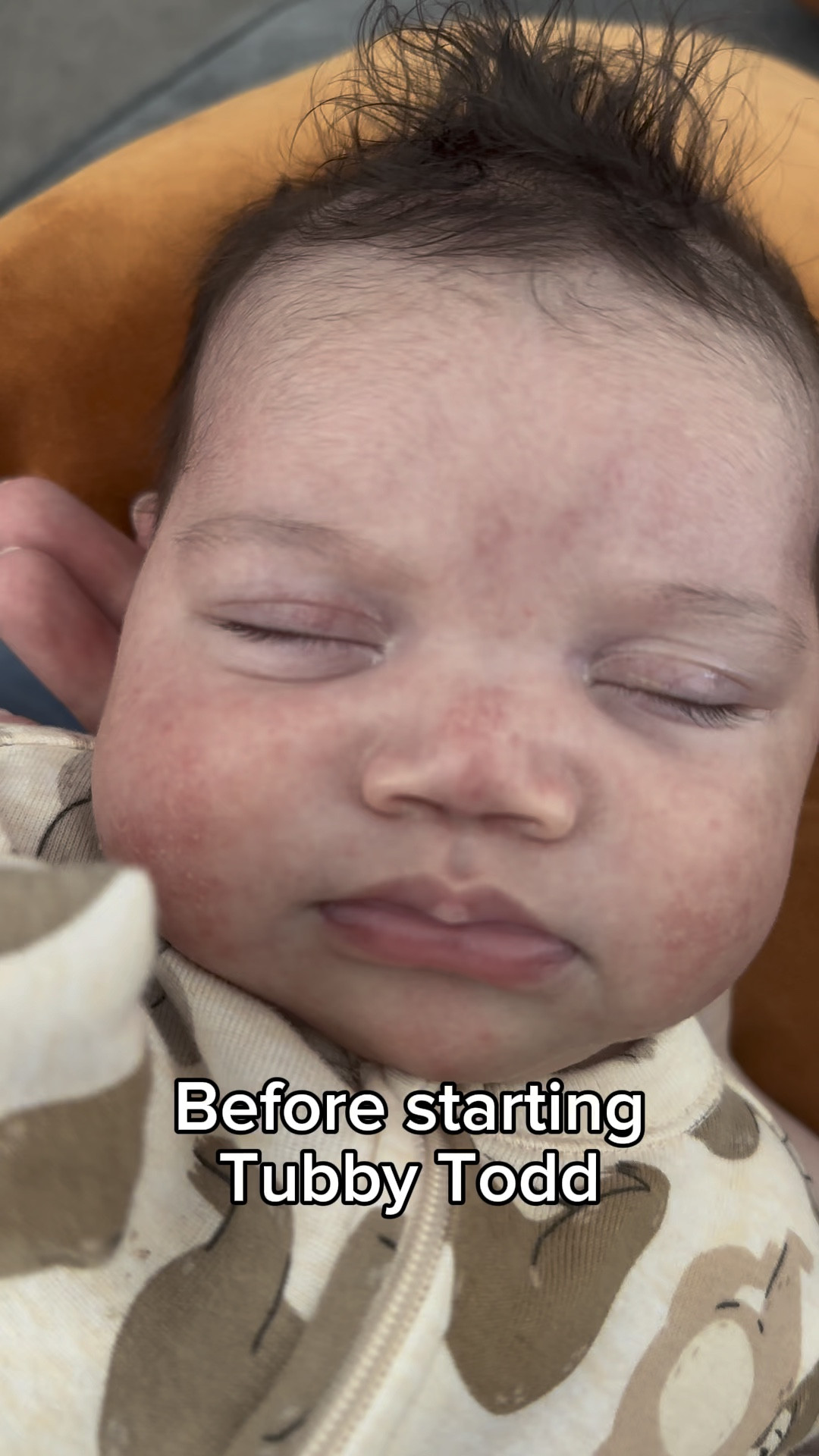 My 6 week old was dealing with baby acne. I didnt want to believe it but Tubby Todd really made a difference! I bought the travel kit from Amazon.

 #newborn #babyacne #tubbytodd 

#LTKBaby #LTKFamily