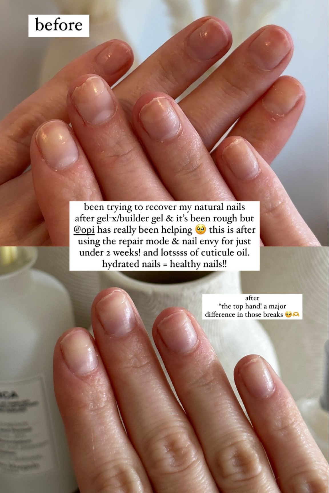 recovering my natural nails from gel x/builder gel has been SO hard but the results from using OPI really speak for themselves!! 

#LTKunder50 #LTKbeauty #LTKFind