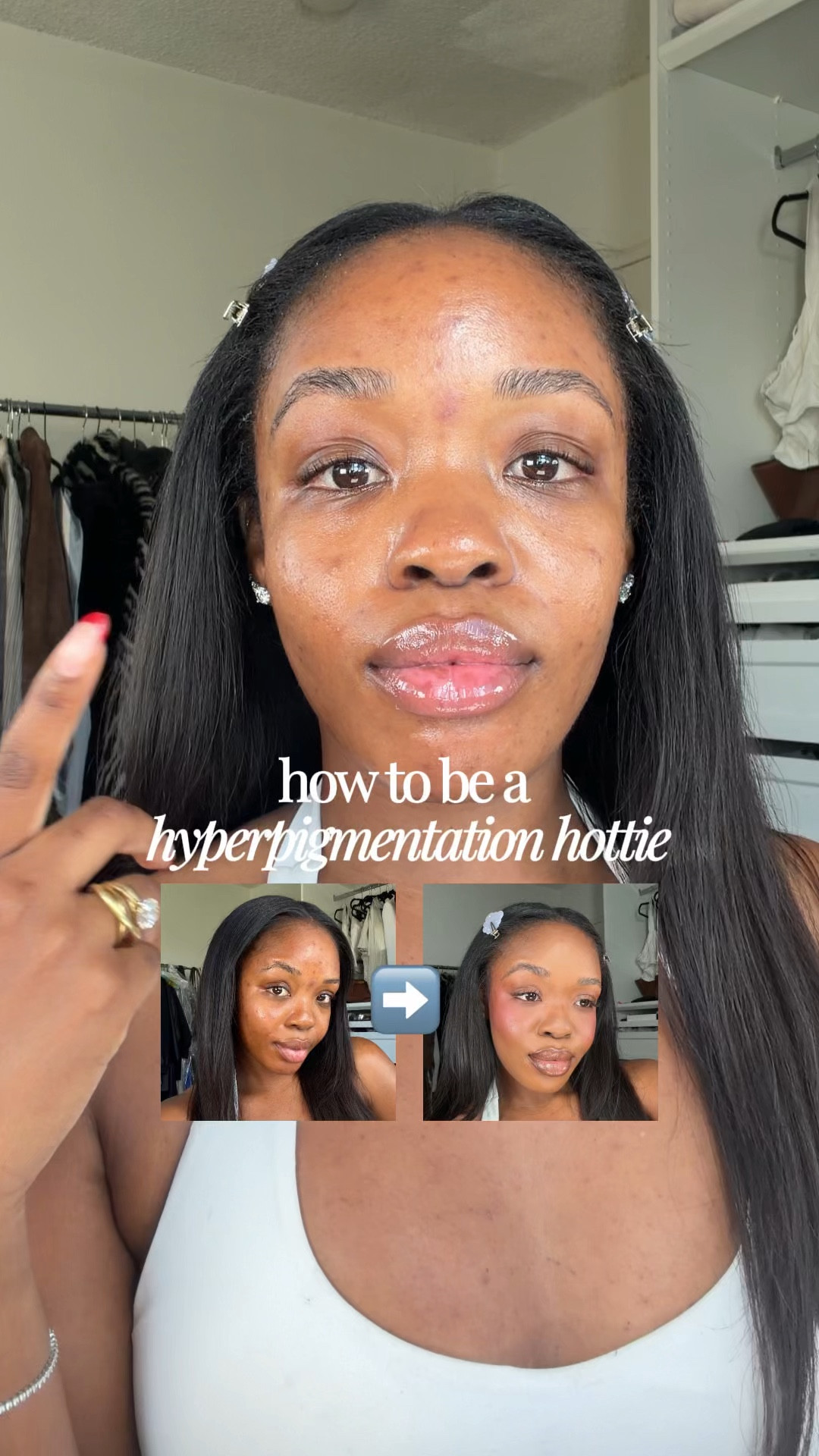 Makeup routine for my hotties with hyperpigmentation! Step-by-step tutorial on how to achieve a flawless base, cover dark spots and accentuate your natural features to feel your most confident✨🤏🏾

#hyperpigmentationhottie #hyperpigmentation #darkskinmakeup #foundationroutine #acnemakeup

#LTKBeauty