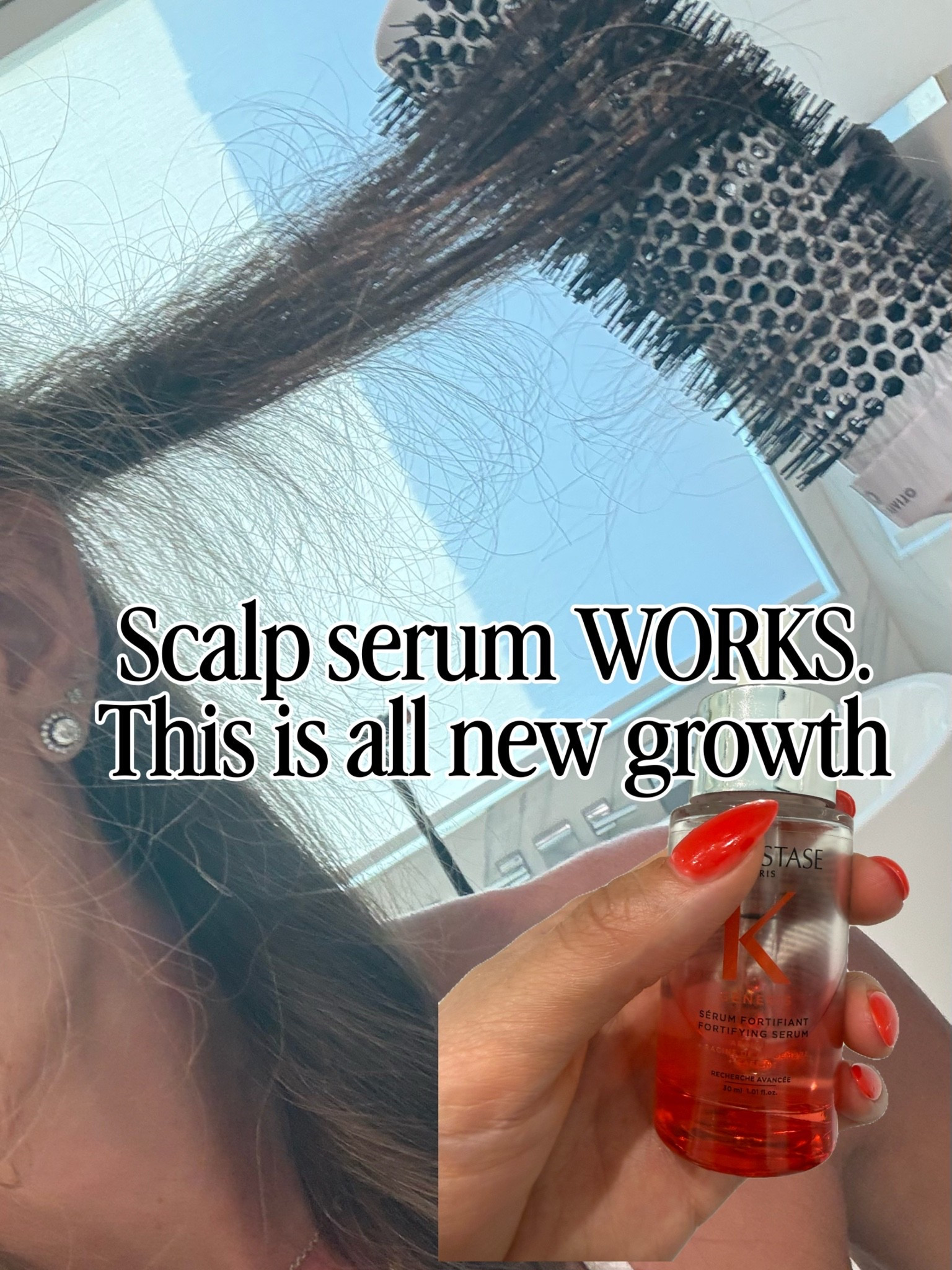 This scalp serum works! So much new growth

#LTKBeauty