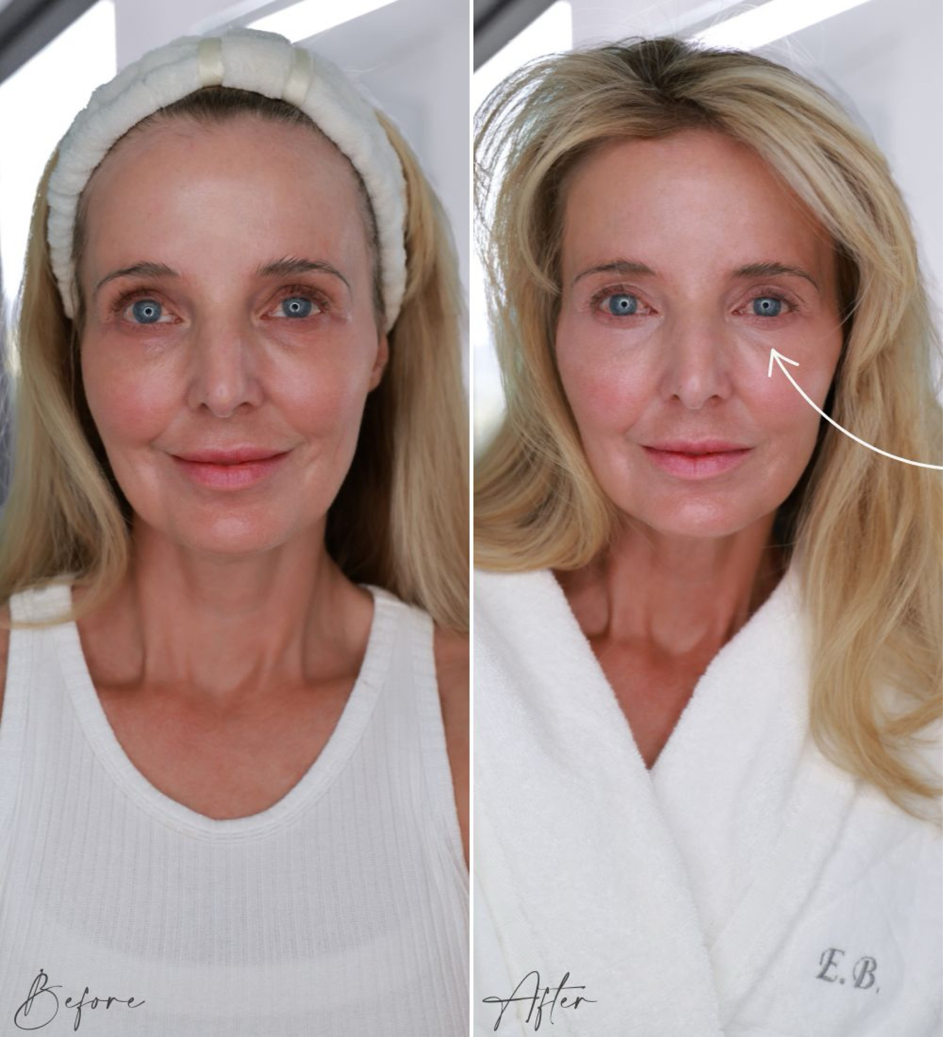 An instant fix for dark circles?? ...This one really works!!! Use code BUSBEE30 for 30% off! 

This eye cream is like magic in a bottle... You can see in the before and after that the eye cream makes a huge difference! The eye without says I’m super tired and beat down, while the other says I got a full 8 hours! 😉 It’s nothing short of amazing how big of a difference this eye cream makes! It also has hyaluronic acid which is very hydrating, perfect for that delicate skin under the eyes. It is a cream, so you don’t really need any additional eye cream underneath unless you want the added moisture. 

Are there any beauty fixes you've been looking for? Or any holy grail products you LOVE? Please be sure to share in the comments below! 

~Erin xo 

#LTKOver40 #LTKFindsUnder50 #LTKBeauty