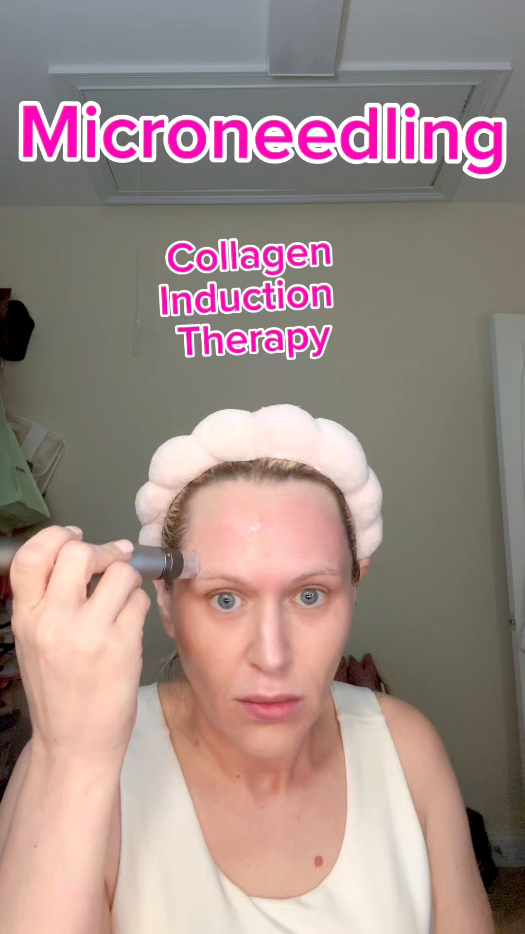 Microneedling, AKA Collagen Induction Therapy: Improves tone and texture 

#LTKBeauty