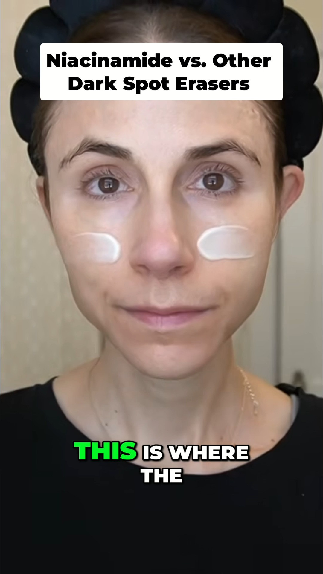 SKIN 1004 TECA cream for dull texture and uneven skin tone. #koreanskincare 

 #LTKBeauty