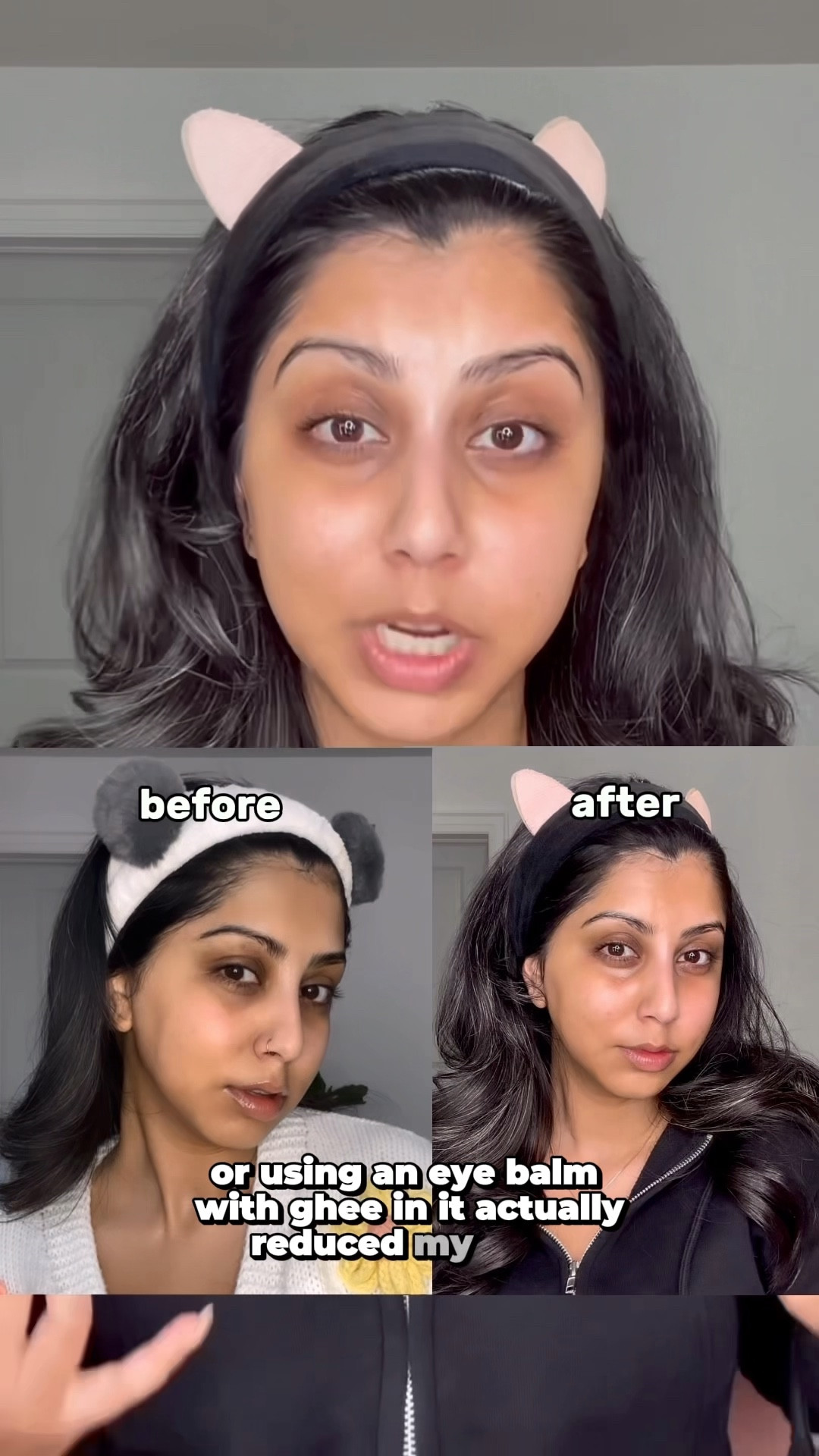 Ayurvedic skincare literally reduced my dark circles, cleared up my skin and made it look brighter! 

#LTKbeauty #LTKstyletip #LTKcanada