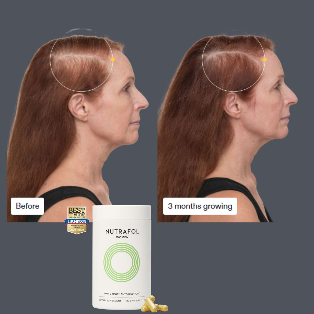 This is the best supplement on the market. #hairloss #nutrafol #longhairdontcare 

 #LTKOver40 #LTKSaleAlert #LTKBeauty