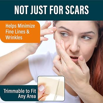 NUVADERMIS Silicone Scar Tape for Surgical Scars - 120" x 1.5" Roll - Extra Long Medical Grade Si... | Amazon (US)