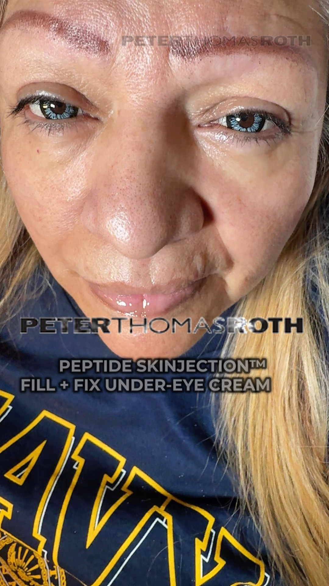✨My Mom
Approved of the
PEPTIDE SKINJECTION™
FILL + FIX
UNDER-EYE CREAM
AS YOU CAN SEE 👀 !!
REAL Results for Deep Wrinkles &
Tired Eyes & CrowFeet
It Works 💥💯
So RUN & Click 🖱️
SHOPNOW

#peterthomasroth 
#undereyebags #dianatheeboss 

#LTKHoliday #LTKselfcare #LTKmorningroutine