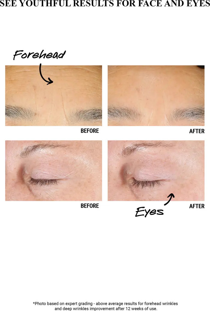 Kiehls Since 1851 Retinol Skin-Renewing Daily Micro-Dose Serum | Nordstrom