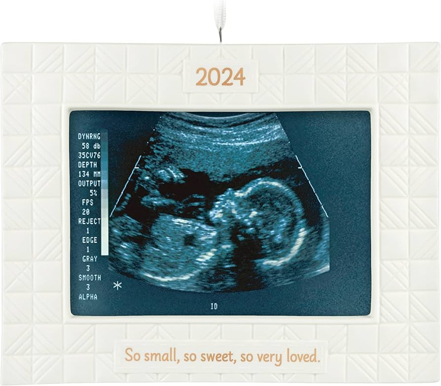 Hallmark Keepsake Christmas Ornament 2024, So Very Loved Sonogram Photo Frame, Porcelain, Baby's ... | Amazon (CA)