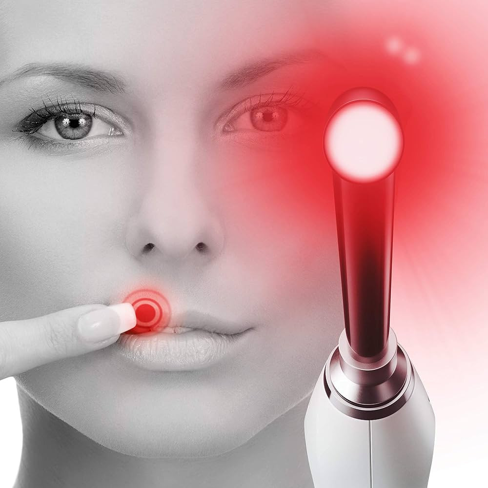 Luminance Red The Proven Cold Sore Device for Pain Relief and Lip Sore Management | Amazon (US)
