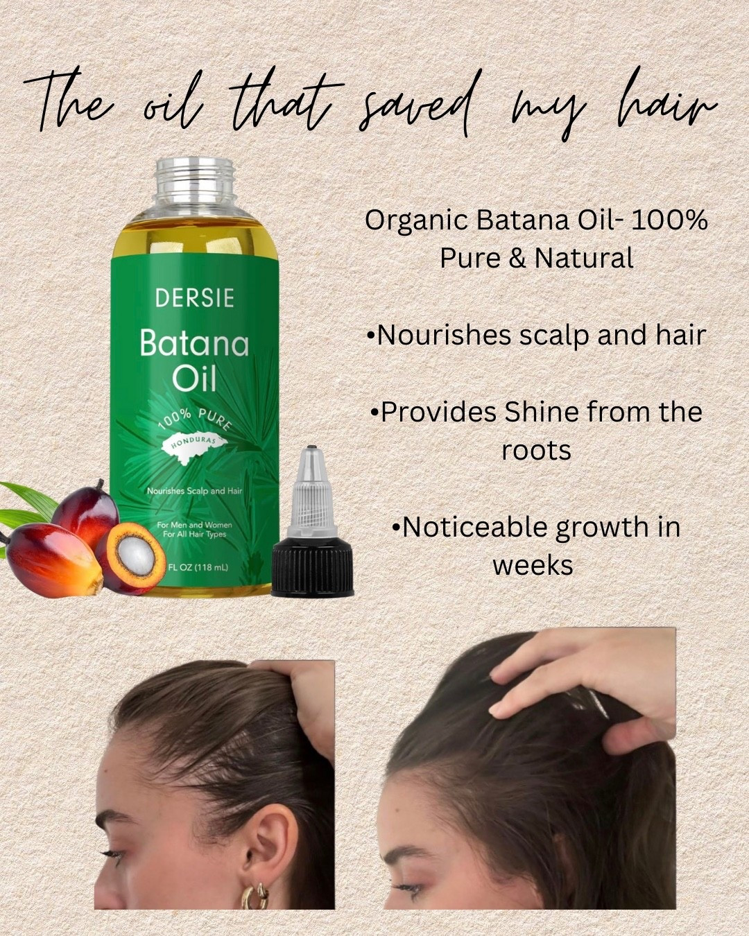 My favorite affordable product for hair growth 
#hair #hairgrowth #tips #amazon @amazonfindsandfashion 

#LTKselfcare #LTKBeauty