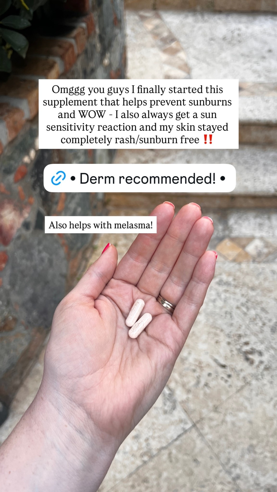 Omggg you guys I finally started this supplement that helps prevent sunburns and WOW - I also always get a sun sensitivity reaction and my skin stayed completely rash/sunburn free ‼️ Also helps with melasma!

#LTKSeasonal #LTKselfcare #LTKmomlife