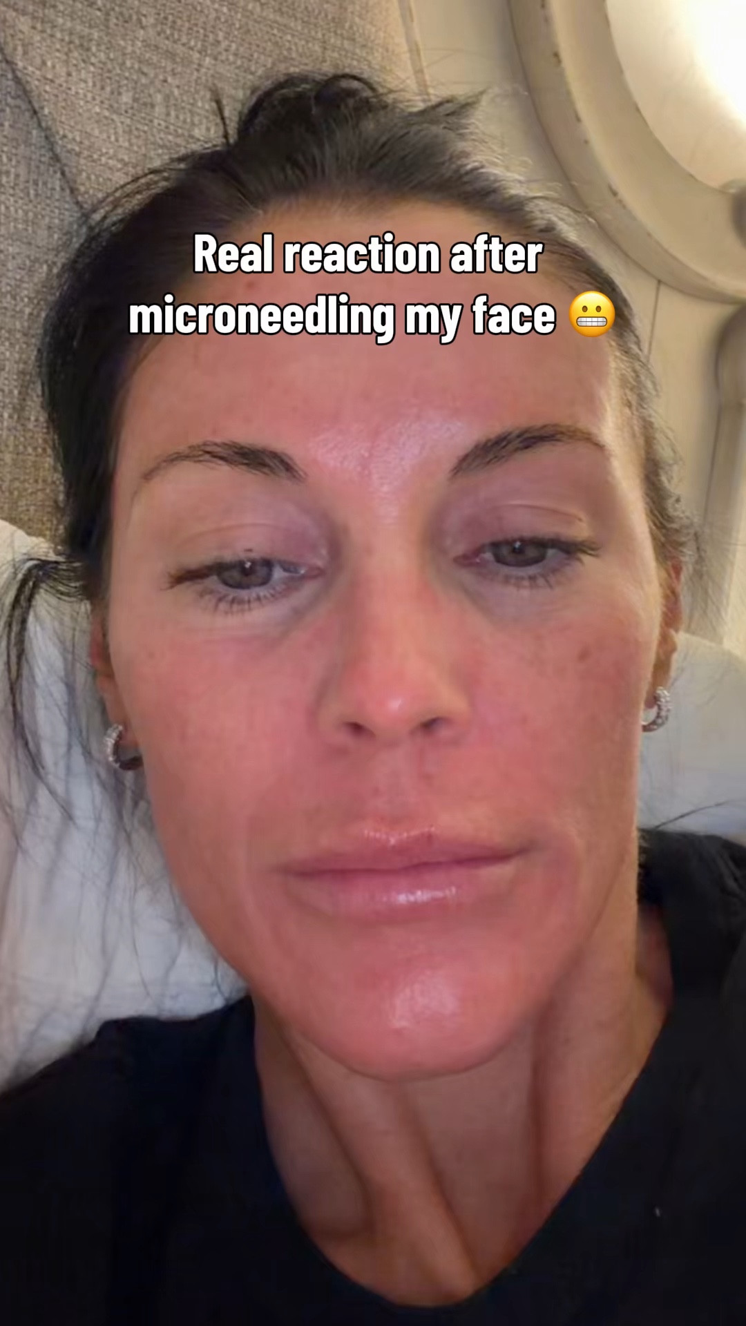 Aiming for glass skin! 

#LTKselfcare