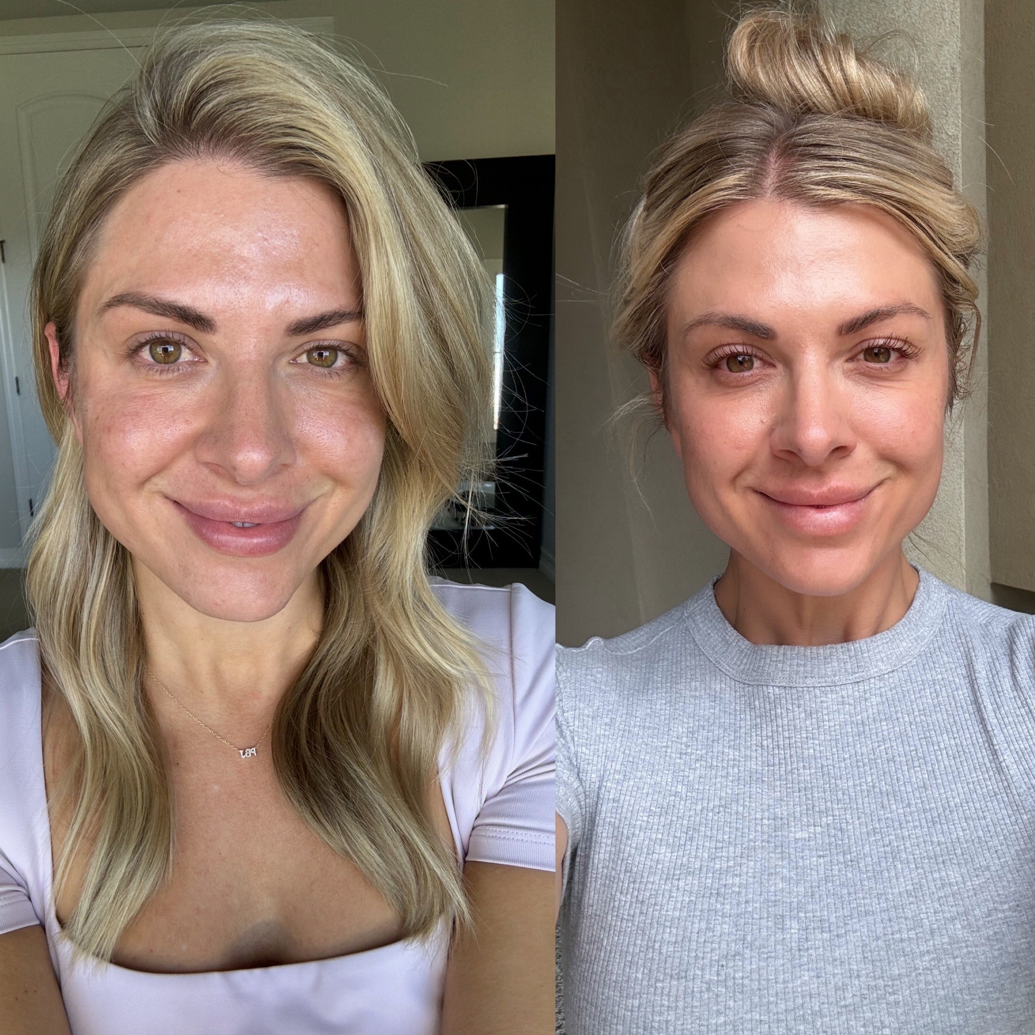 Love medical grade products! This even skin toner is my favorite-it has helped so much with keeping my melisma and evening my skin tone so much over the last year! I also SWEAR by trio balance moisturizer 

#LTKFindsUnder100 #LTKFindsUnder50 #LTKBeauty