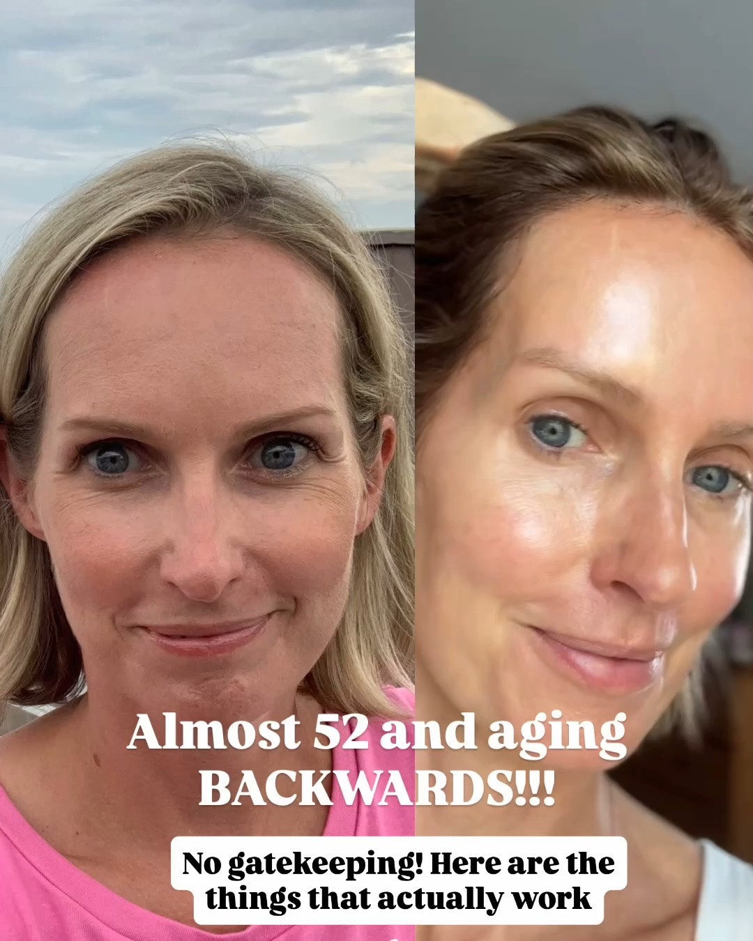 Almost 52 and honestly… these are the things that have made the biggest difference in how I look and feel lately ✨

✔️ Prioritizing skincare over heavy makeup
✔️ Strength training + daily walks
✔️ Hydration (inside and out)
✔️ Focusing on sleep, stress, and hormones

….and my beauty products and treatments I am not gatekeeping! 

Aging backwards isn’t about looking 25 again. It’s about looking healthy, glowy, rested, and like the best version of yourself at every age 🤍

#Over50Beauty #MatureSkinMakeup #WomenOver50 #AgingGracefully #Over40

#LTKOver40 #LTKselfcare