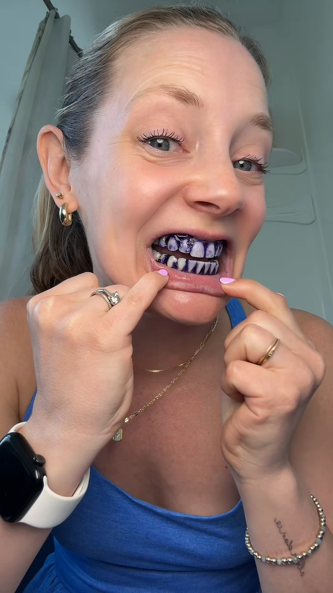 The whitest spring teeth I’ve ever seen 😁

#LTKgrwm #LTKselfcare #LTKBeauty