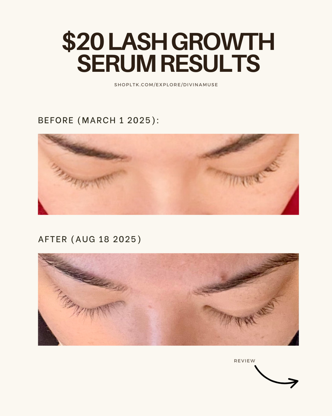 Saw this $20 lash growth serum on TikTok and decided to try it. I think it's one of the best lash serums. It's from Terez & Honor and I'm so glad I ordered it. My lashes are stronger, healthier, longer, and slightly thicker. Applying mascara is what made it super obvious it was working. This doesn't sting my eyes like other serums I've tried, and is worth every penny. It lasts a long time (I'm on month 6 now), and I only use it once every day before bed. #lashserum #amazonbeauty #amazonfind #lashgrowthserum 

 #LTKSaleAlert #LTKFindsUnder50 #LTKBeauty