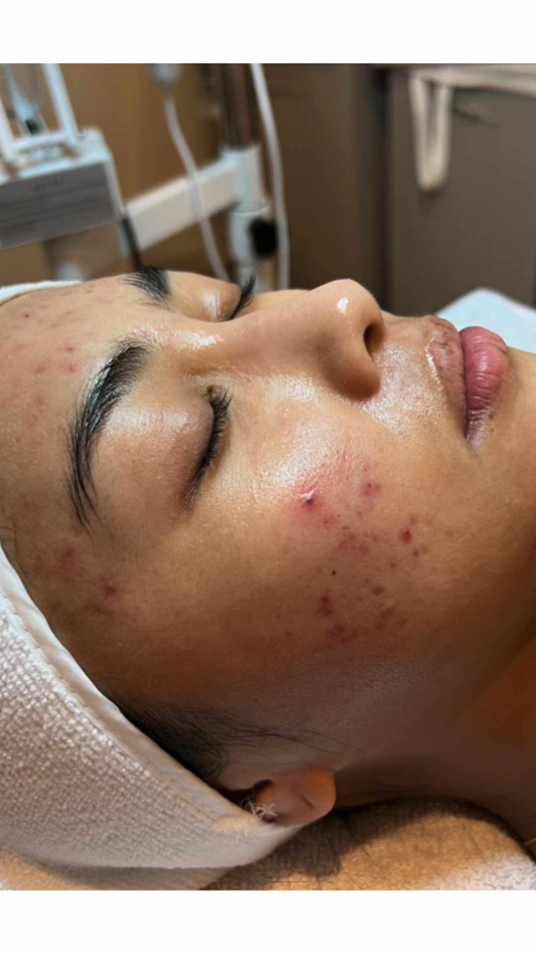 Skincare products that took my skin from inflamed and irritated to hydrated and clear! Use code: SAVEMORE at checkout xx 

#LTKWatchNow #LTKSaleAlert #LTKBeauty