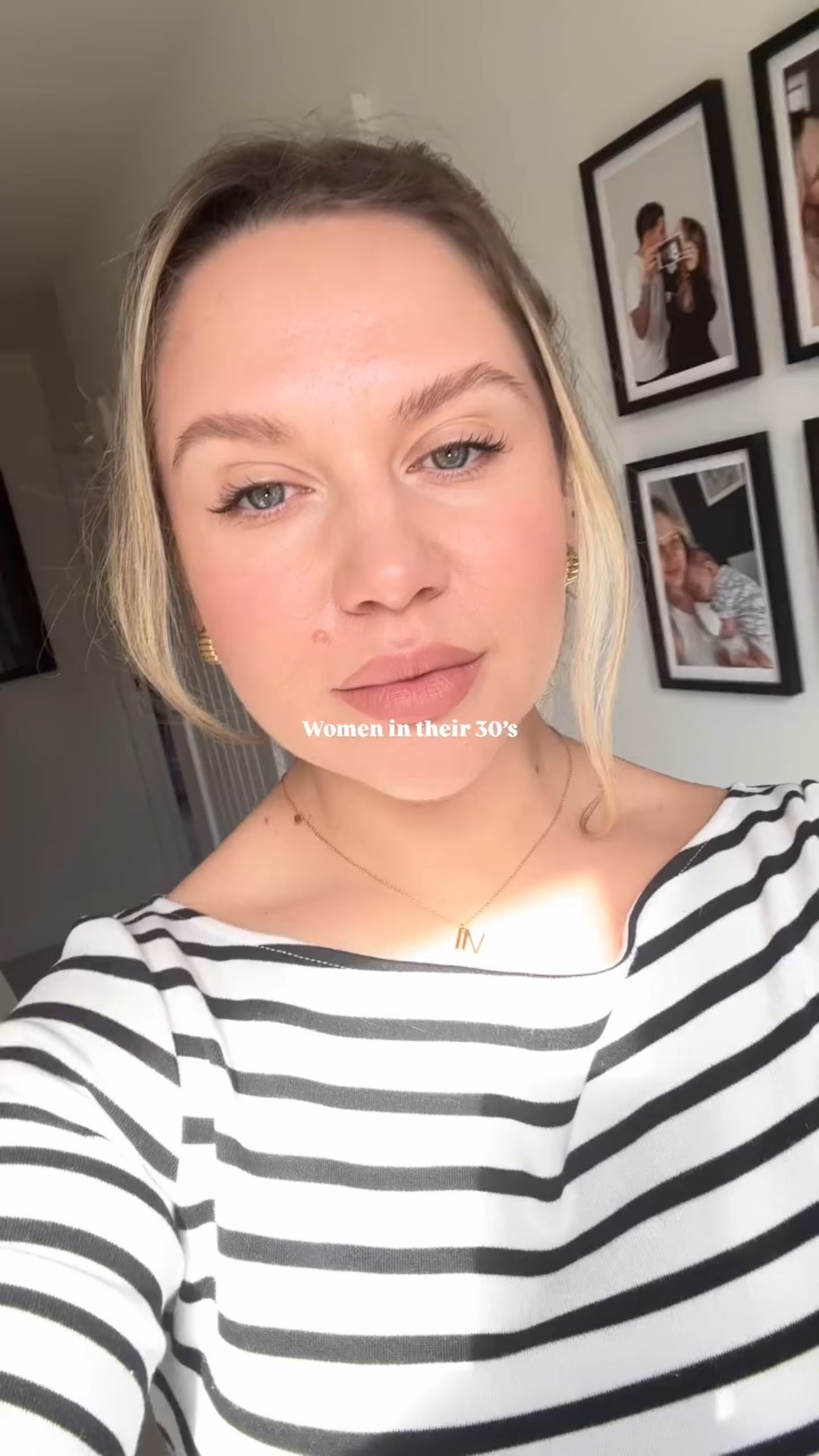 32 & best skin I’ve ever had in my life 🥹🥰🦋✨

~ obsessed with how plump my skin feels after my 2nd session of microneedling with @cavendishclinicuk ✨☺️ use code SKAI15 for 15% off at your local clinic! 🦋 (pr)

#womenintheir30s #skincareisselfcare #wellnessmama #wellnessinfluencer #mindfullifestyle #holistichealthandwellness