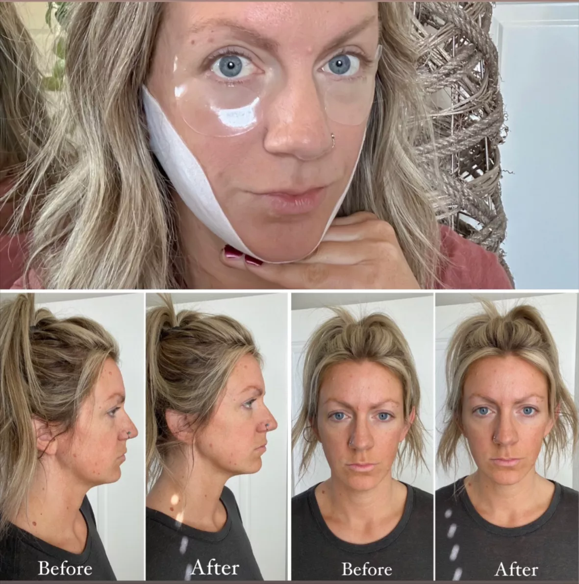 I Tried the Lauer V-Shaped Face-Slimming Mask That  Shoppers