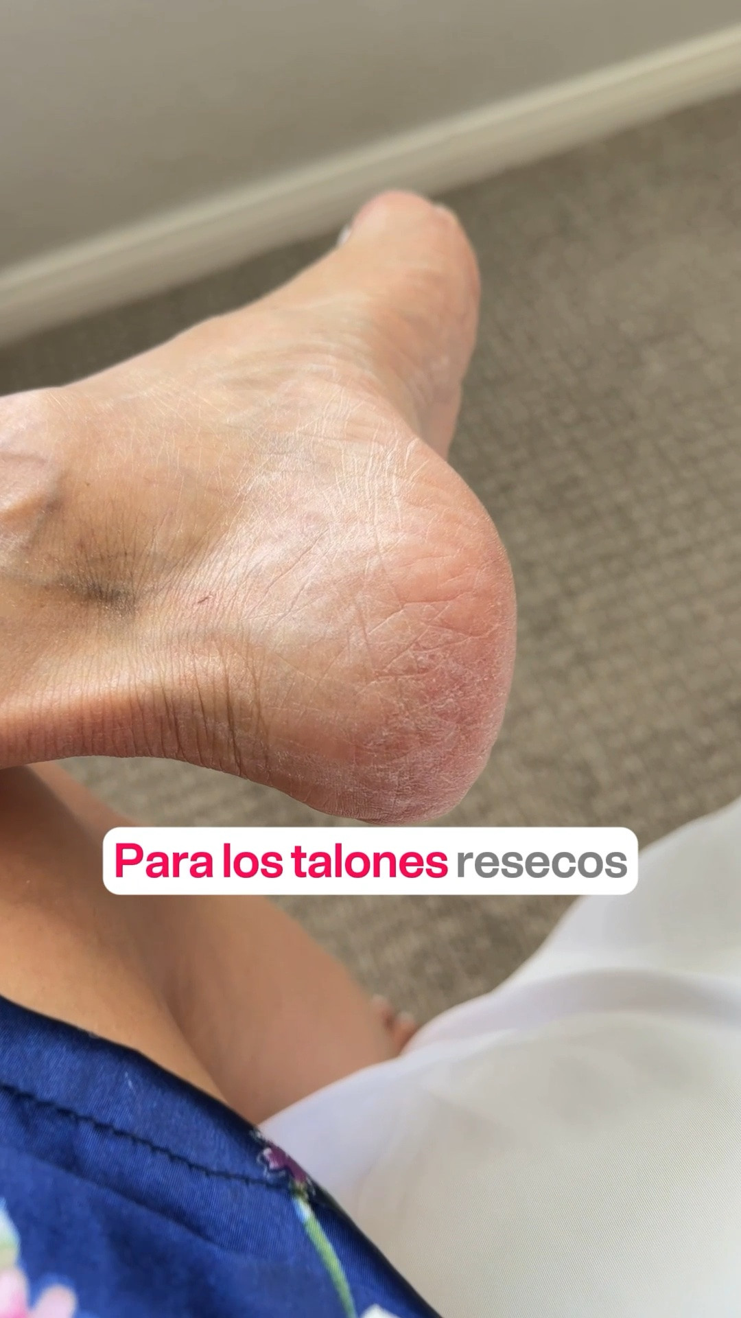 Para los talones resecos

#LTKselfcare #LTKOver40 #LTKBeauty